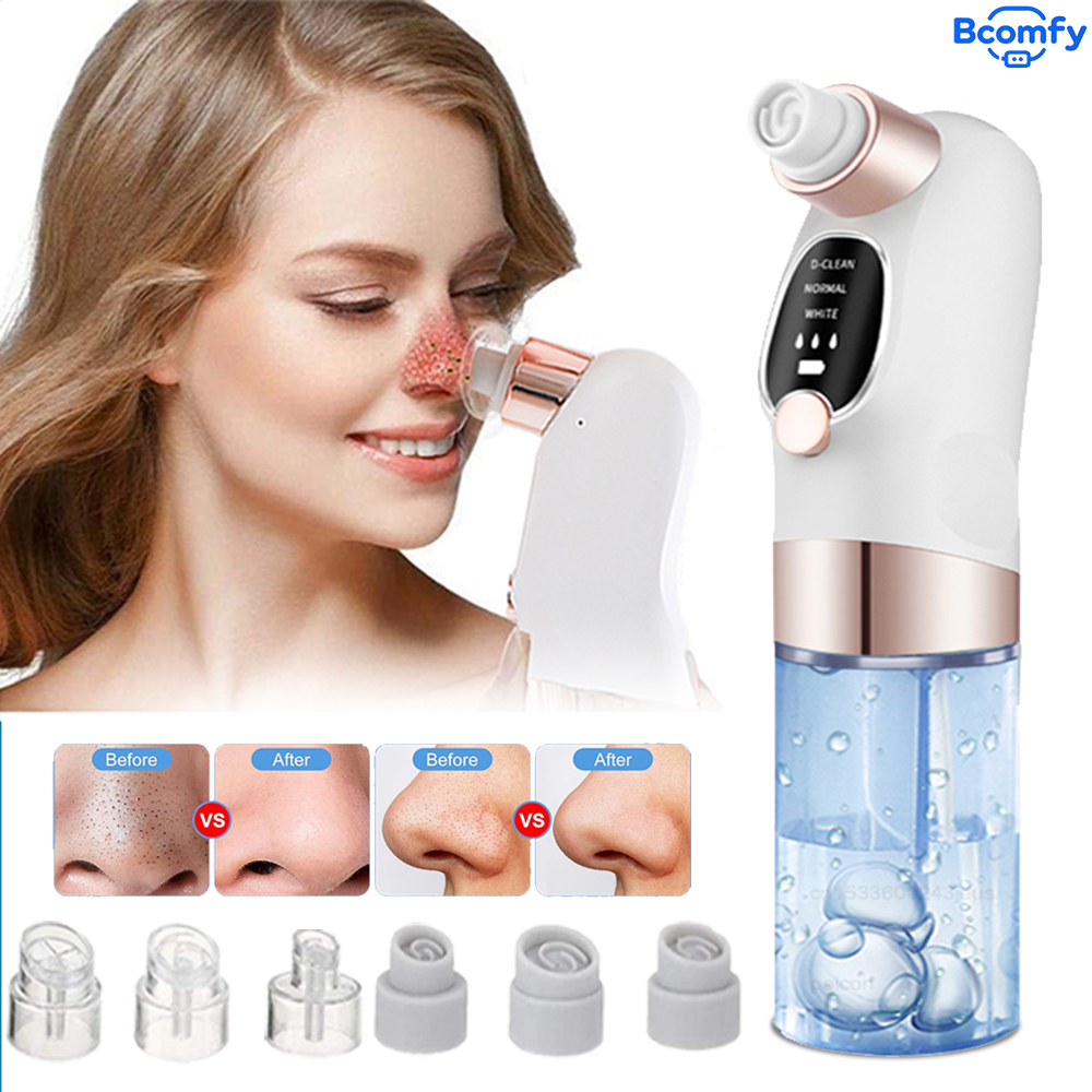 Электрический вакуумный очисти – обзор и цена Pore Vacuum