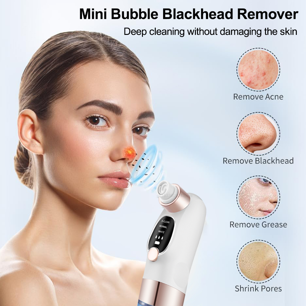 Электрический экстрактор черны – обзор и цена Pore Vacuum