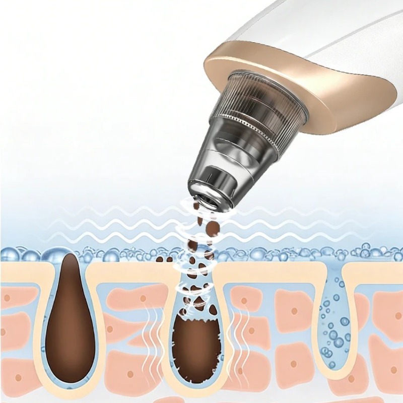 Вакуумный очиститель пор для л – обзор и цена Pore Vacuum