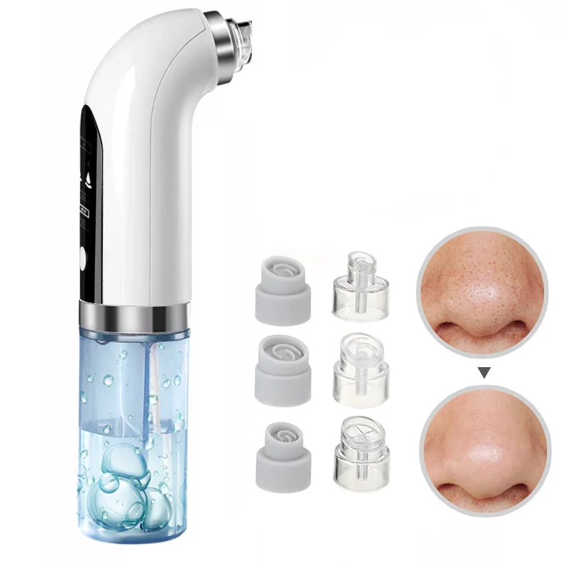 Электрический вакуумный очисти – обзор и цена Pore Vacuum